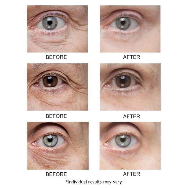 Nuclei Instant Eye Tightener